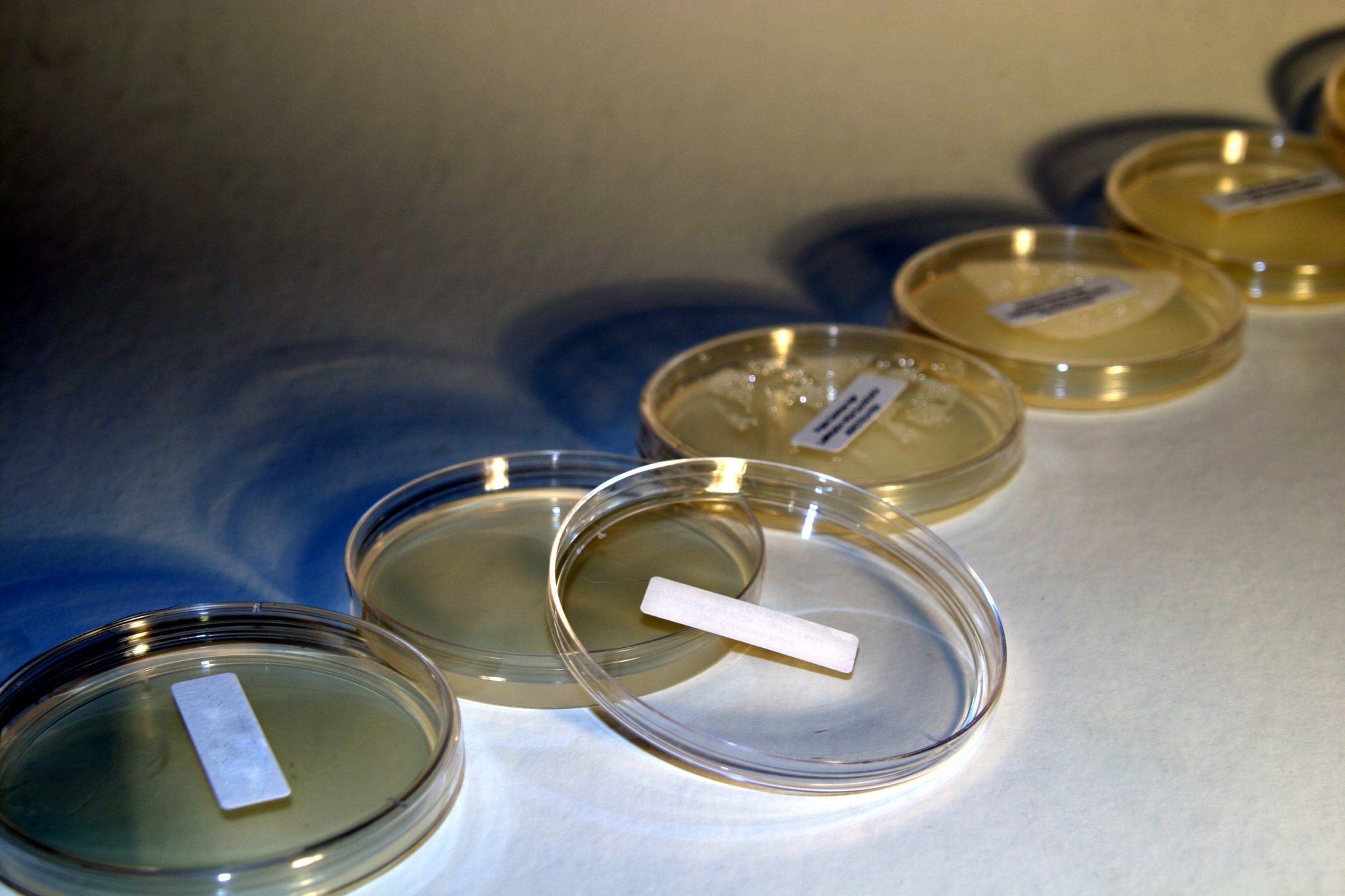 Bacteria Testing and E. coli Testing in California A1 Certified